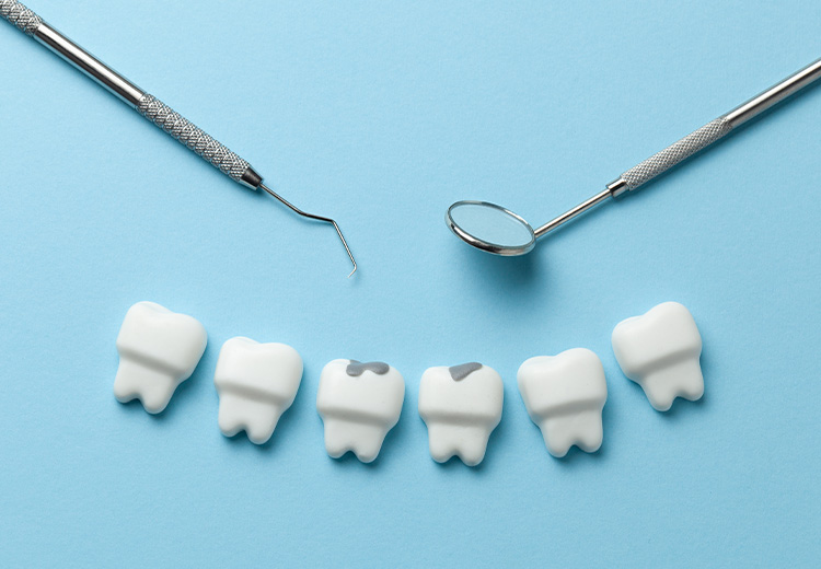 虫歯・歯周病の予防や早期発見・早期治療ができる